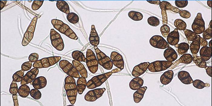 Vermehrung des Pilzes alternaria alternata