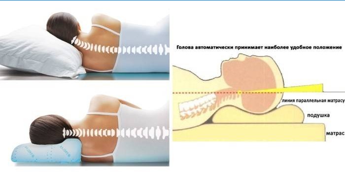 Die Verwendung von orthopädischen Kissen mit Memory-Effekt