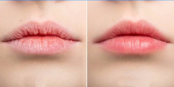 Lippen vor und nach dem Auftragen des Balsams